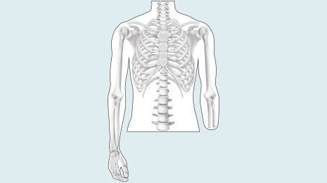 Resultado de imagen para amputacion transradial